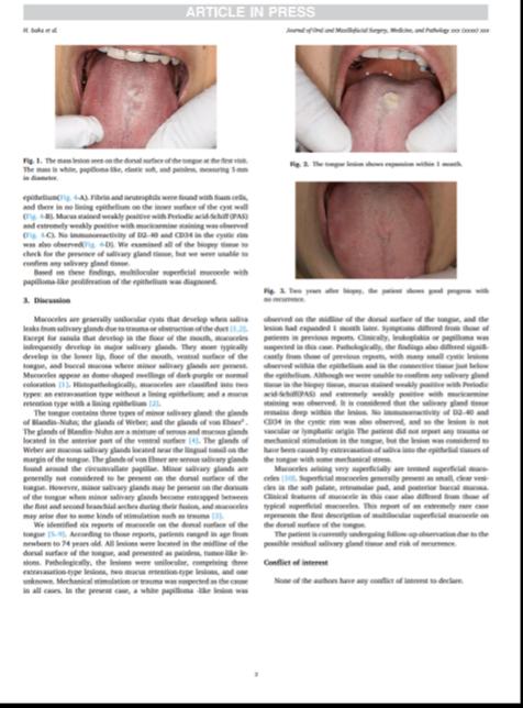 アジア口腔外科学会誌「Journal of Oral and Maxilofacial Surgery, Medicine, and Pathology」に当院Drが執筆した論文が掲載されました。