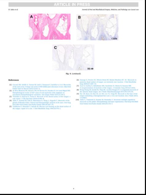 アジア口腔外科学会誌「Journal of Oral and Maxilofacial Surgery, Medicine, and Pathology」に当院Drが執筆した論文が掲載されました。