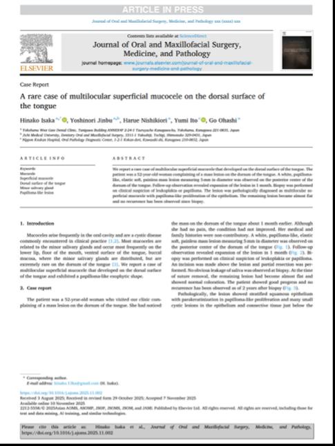 アジア口腔外科学会誌「Journal of Oral and Maxilofacial Surgery, Medicine, and Pathology」に当院Drが執筆した論文が掲載されました。